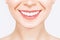 Perfect healthy teeth smile of a young woman. Teeth whitening. Dental clinic patient. Image symbolizes oral care