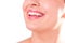 Perfect healthy teeth smile of a young woman. Teeth whitening. Dental clinic patient. Image symbolizes oral care dentistry,