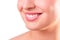 Perfect healthy teeth smile of a young woman. Teeth whitening. Dental clinic patient. Image symbolizes oral care dentistry,