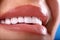 Perfect White beautiful Teeth smile ceramic crowns whitening young lady smiling. zircon implants restoration