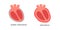 Pericarditis heart disease