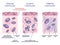 Perichondrium as hyaline and elastic cartilage membrane outline diagram