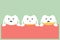 Periodontal disease with plaque or tartar