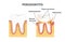 Periodontitis, dental disease.