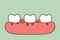 Periodontitis or gum disease with bleeding - teeth cartoon vector flat style