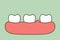 Periodontitis or gum disease with swell - teeth cartoon vector flat style