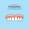Periodontitis human gum inflammation illustration vector on blue