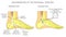 Peroneal Tendon Injuries_Degeneration of the peroneus longus and