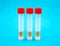 Pharyngeal swab and tube