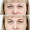 Photo comparison before and after permanent makeup, tattooing of eyebrows