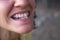 Photo of crooked woman teeth