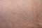Photo of man`s skin with scar burn, closeup photo