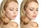 Photo before and after retouch, collage. Portrait of beautiful young woman on white background