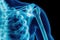 This photo showcases a blue x-ray image of a human skeleton, providing detailed insight into the internal structure, X-ray visual