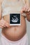 Photo ultrasound in the hands of a pregnant girl on a belly background