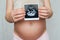 Photo ultrasound in the hands of a pregnant girl on a belly background