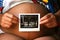 Photo of an ultrasound sonogram