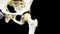 Photograph of articulated hip joint in black background