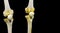 Photograph of bilateral articulated knee joint in black background