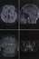 Photography of human brain magnetic resonance imaging