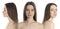 Photos of woman with lifting marks on face against white background, collage. Cosmetic surgery