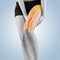 Physiotherapy treatment with therapeutic tape for leg pain.