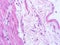 picture of histology human tissue with microscope from laboratory (not Illustration Designation)