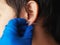 Piercing and stretching the ears with medical  blue gloves. increase the diameter of the ear tunnels