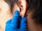 Piercing and stretching the ears with medical  blue gloves. increase the diameter of the ear tunnels