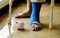 A piggy bank with a man`s leg uses crutches to walk after surgery recovery injury broken bones