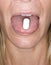 Pill on tongue