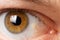 Pinguecula eyes macro photo close-up of the male eye. Yellow education on squirrel, farmer`s eye