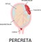 Placenta accreta. grades of abnormal attachment illustrated according to the depth