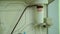 Plasmapheresis. Cleaning the patientâ€™s blood through the device. The process of excretion of blood plasma from the