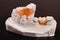 Plaster cast of teeth with removable partial denture on a dark background