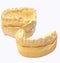 Plaster impression of the dental apparatus-