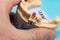 Plaster models of the jaws in the hands of a dental technician in a dental laboratory