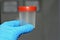 A plastic urine test container for laboratory analysis urinalysis, a test to detect and manage a wide range of disorders, such as