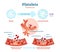 Platelets or thrombocyte activation fibrin in blood vessel vector illustration diagram. Anatomical blood scheme.