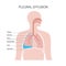 Pleural effusion poster