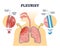 Pleurisy or pleuritis disease as medical lung inflammation outline diagram