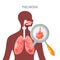 Pneumonia disease vector icon in flat style