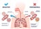 Pneumonia illness medical comparison with healthy lungs outline diagram