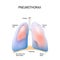 Pneumothorax. Collapsed lung.