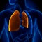 Pneumothorax - Collapsed Lung