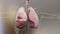 Pneumothorax, Hemothorax and Hemopneumothorax, Normal lung versus collapsed,