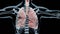 Pneumothorax, Normal lung versus collapsed, symptoms of pneumothorax, pleural effusion, empyema