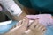 Podiatrist treating onychomycosis with a laser