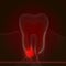 Point styling with a point of pain and inflammation. Medical illustration of tooth root inflammation, tooth root cyst, pulpitis. X