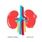 Polycystic kidney disease vector